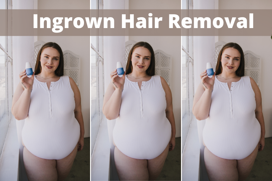 ingrown hair removal